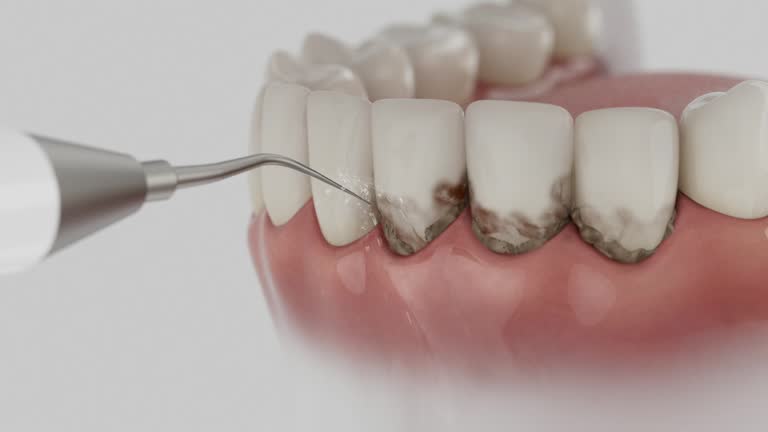 Trusted Wisdom Tooth Removal service in Ralls, TX - Dentist Open Now